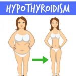 How to lose weight with Hyperthyroidism | Diet Plans for women to lose weight with thyroid problems | yourfitnessjourneytoday.com